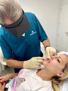 aumento de labios en marbella, eliminación de arrugas en área peribucal, marbella, dr campos