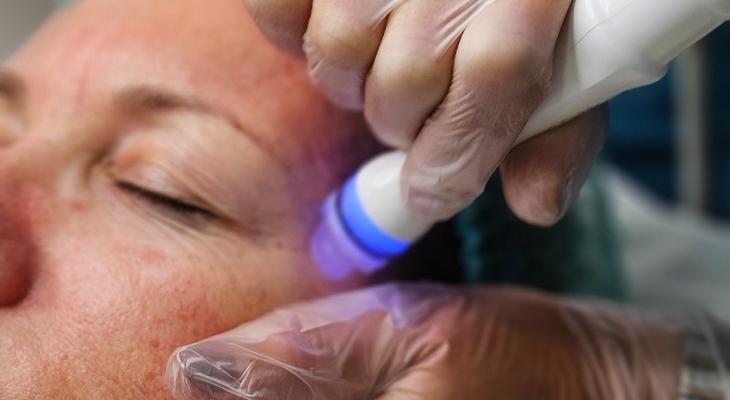 mejor limpieza facial en marbella, belleza, clinica estetica marbella, aquapure marbella