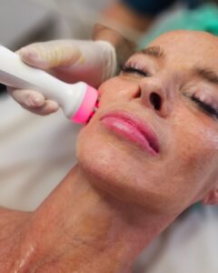 mejor limpieza facial en marbella, aquapure marbella, belleza marbella, cuidado facial marbella