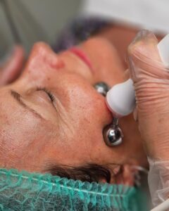 limpieza facial en Marbella, el mejor tratamiento facial en marbella, cuidado facial marbella. 