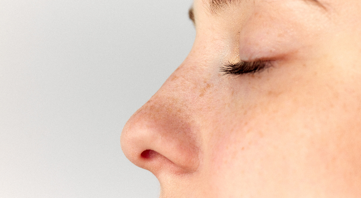 Ventajas y desventajas de la rinoplastia ultrasónica